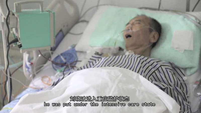 諾貝爾和平獎得主、中國民主人權運動領袖劉曉波在瀋陽中國醫科大學附屬第一醫院接受治療的畫面。(AP) 諾貝爾和平獎得主、中國民主人權運動領袖劉曉波在瀋陽中國醫科大學附屬第一醫院接受治療的畫面。(AP)