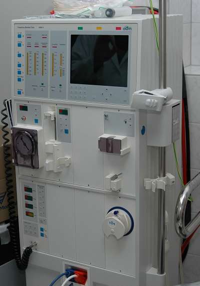 血液透析機(圖/維基百科) 血液透析機(圖/維基百科)