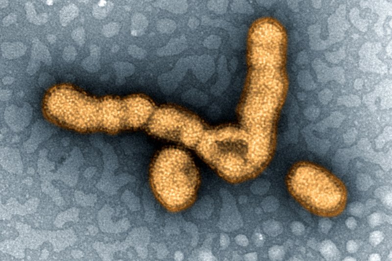 A型H1N1流感病毒(維基百科) A型H1N1流感病毒(維基百科)
