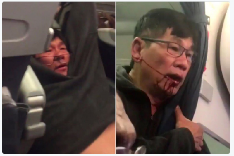 美國聯合航空周日(9日)晚間將一名69歲華裔乘客強行拖下機,過程中男子受傷,滿臉是血。(截圖自推特)