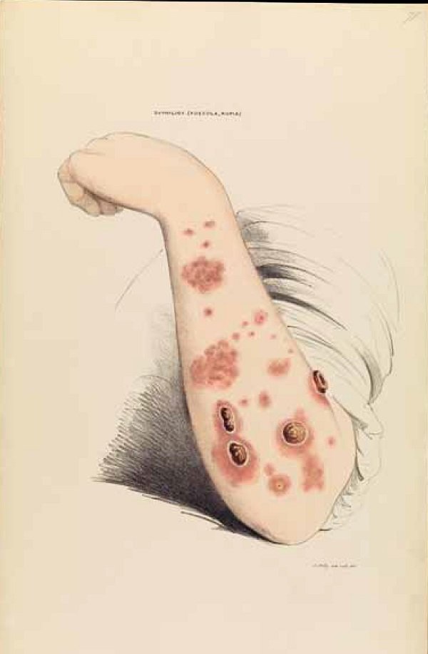 6 6