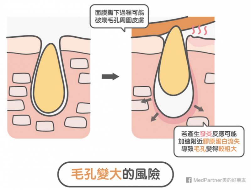 圖 圖