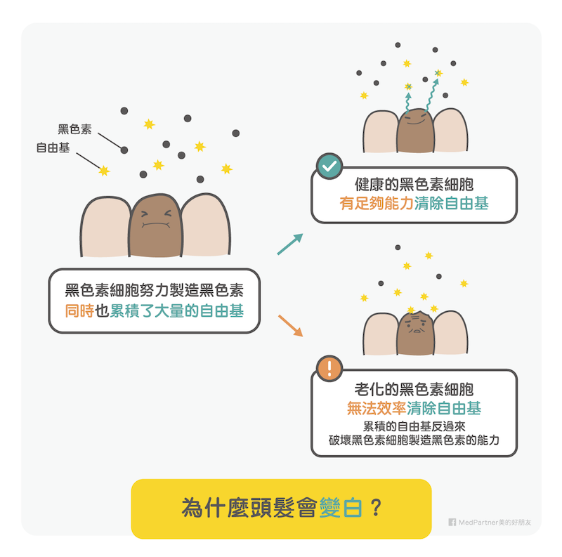 白頭髮_頭髮變白(圖/美的好朋友提供) 白頭髮_頭髮變白(圖/美的好朋友提供)