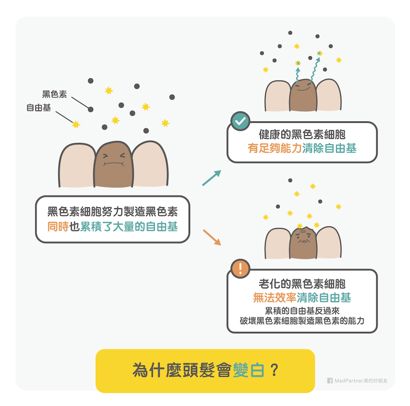 白頭髮_頭髮變白（圖／美的好朋友提供）