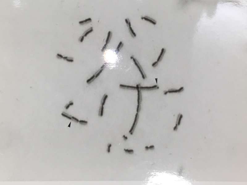 顯微鏡下,姊妹染色分體互換基因片段的結果。(黑色箭頭指示處)(圖/嚴愛鑫,研之有物提供) 顯微鏡下,姊妹染色分體互換基因片段的結果。(黑色箭頭指示處)(圖/嚴愛鑫,研之有物提供)