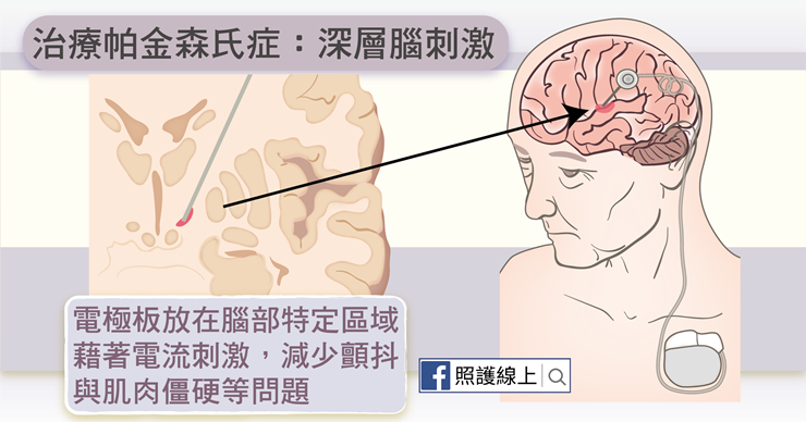 (圖/照護線上提供) (圖/照護線上提供)