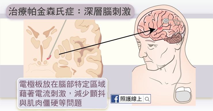 （圖／照護線上提供）