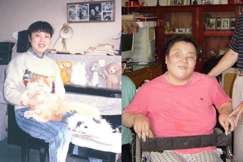 朱令被下毒後重度殘廢、智力只剩7歲。(圖/百度百科) 朱令被下毒後重度殘廢、智力只剩7歲。(圖/百度百科)