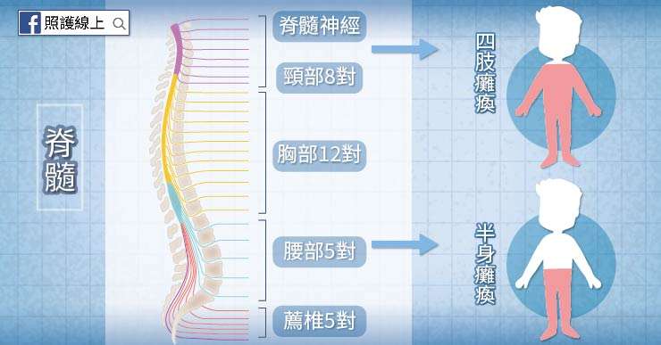 (圖/照護線上) (圖/照護線上)