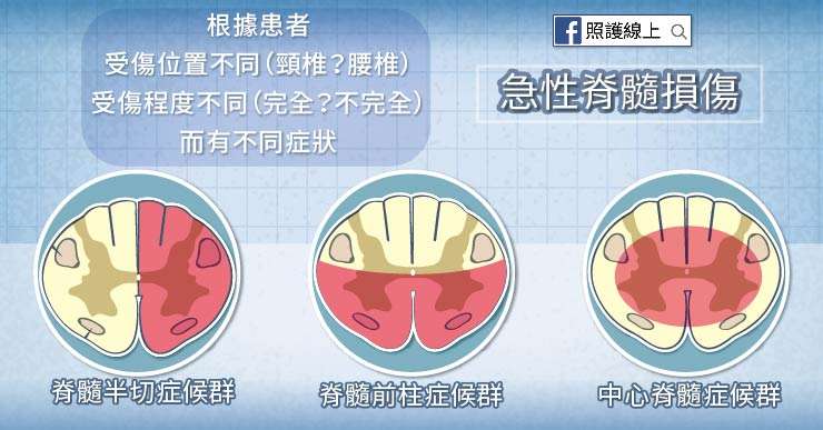(圖/照護線上) (圖/照護線上)