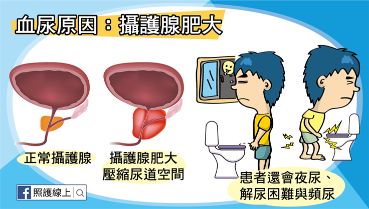 血尿懶人包-07.png(圖/照護線上) 血尿懶人包-07.png(圖/照護線上)