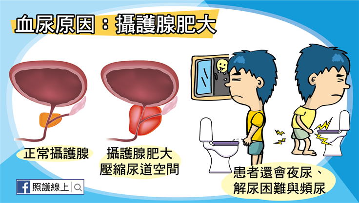 血尿懶人包-07.png（圖/照護線上）