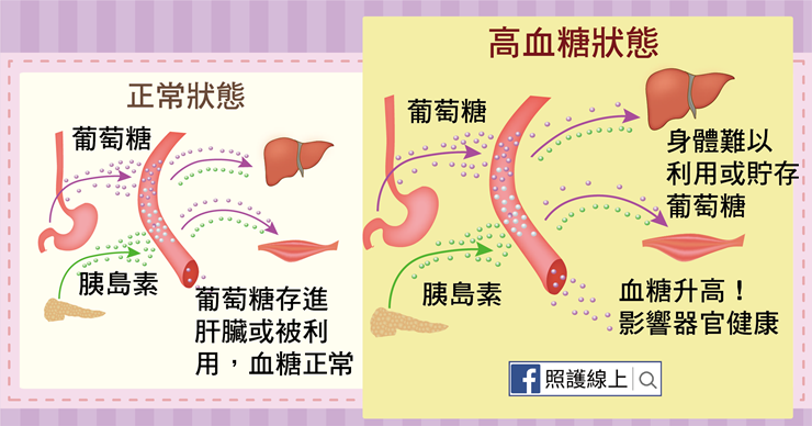 糖尿病前期-04.png(圖/照護線上) 糖尿病前期-04.png(圖/照護線上)