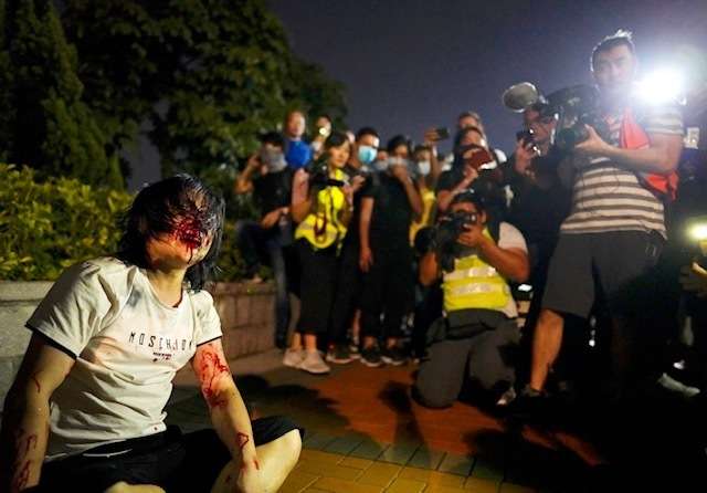 2019年9月,香港「反送中」運動,支持中國民眾遭到毆打(AP) 2019年9月,香港「反送中」運動,支持中國民眾遭到毆打(AP)
