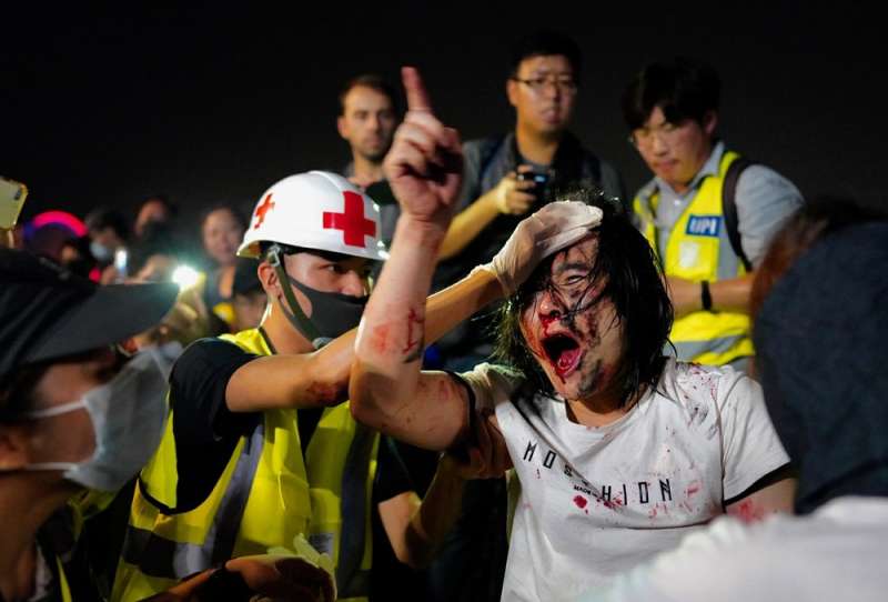 韓麗珠以「業」的觀點看反送中運動過程民眾的流血與傷亡。（AP）