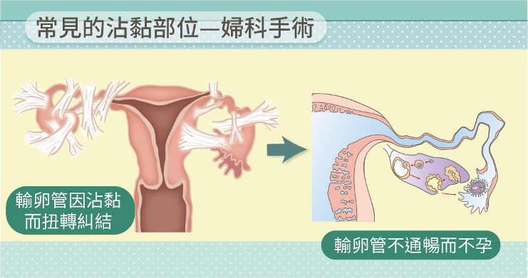 (圖/Care online提供) (圖/Care online提供)