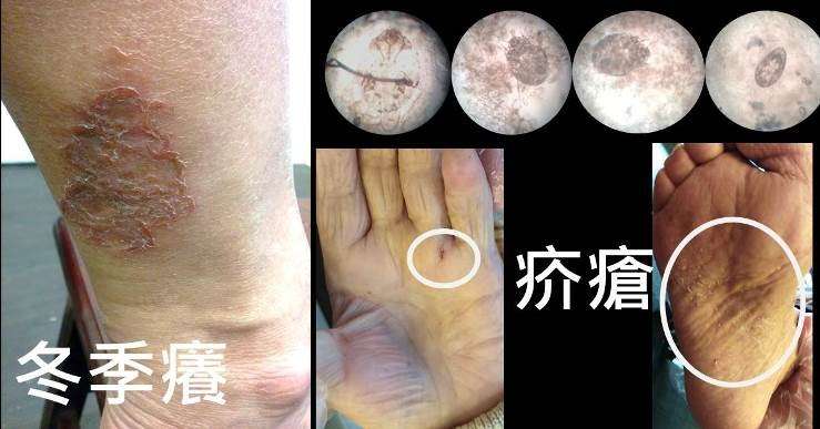 (圖/照護線上) (圖/照護線上)