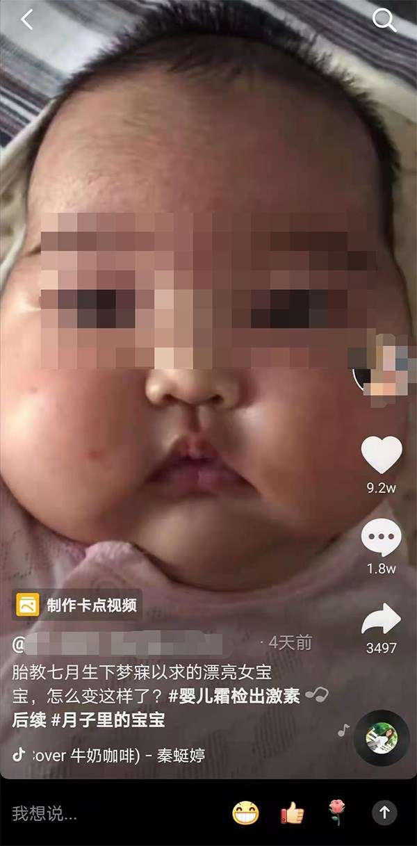 中國又爆出另一個廣東生產的「嬰親霜」也有問題,多名嬰兒使用後出現臉部腫大、多毛等「大臉娃娃」症狀(圖/取自澎湃新聞網站) 中國又爆出另一個廣東生產的「嬰親霜」也有問題,多名嬰兒使用後出現臉部腫大、多毛等「大臉娃娃」症狀(圖/取自澎湃新聞網站)