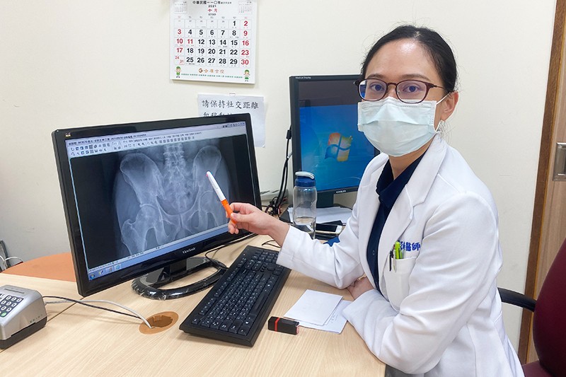 黎亞綺醫師提醒,僵直性脊椎炎若無及早發現治療,嚴重恐會造成關節沾黏變形,影響患者行動及生活品質 黎亞綺醫師提醒,僵直性脊椎炎若無及早發現治療,嚴重恐會造成關節沾黏變形,影響患者行動及生活品質